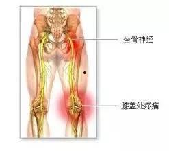 体育明星腰间盘突出,揭秘体育明星腰间盘突出的康复之路