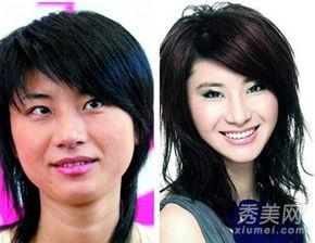 垫下巴女明星,揭秘美丽背后的秘密与争议